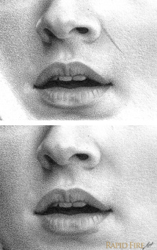 Shading Smile Lines RFA