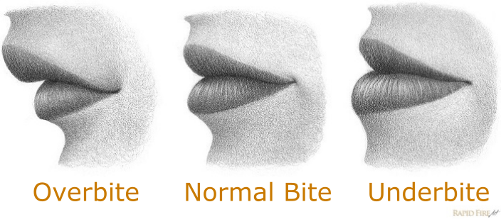 how-to-draw-lips-from-the-side_-overbite-normal-bite-underbite